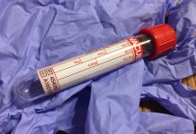 BỆNH TIỂU ĐƯỜNG