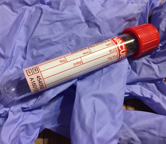 BỆNH TIỂU ĐƯỜNG