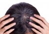 Tìm hiểu về hiện tượng tóc bạc sớm