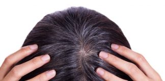 Tìm hiểu về hiện tượng tóc bạc sớm